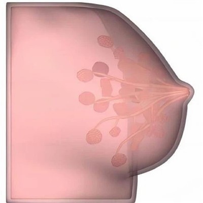 Breast Model (B-Ultrasound Guided Puncture Model)